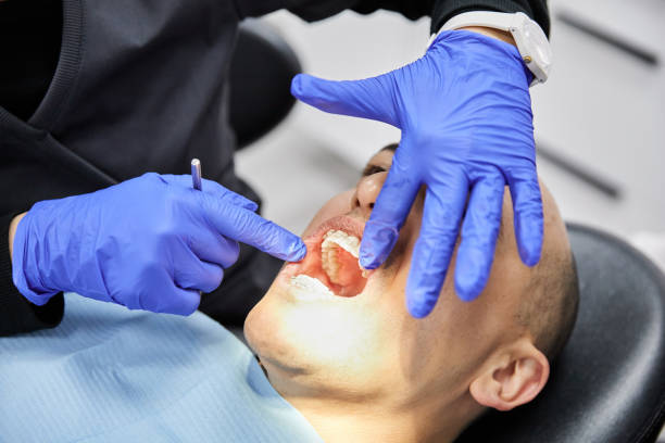 Best Emergency Wisdom Teeth Removal in Arlington, GA
