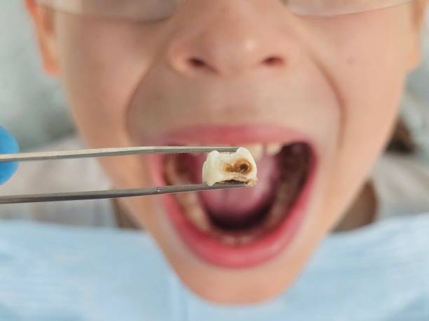 Best Same-Day Emergency Dental Services in Arlington, GA